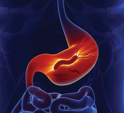 Helikobakter pylori ako liečiť